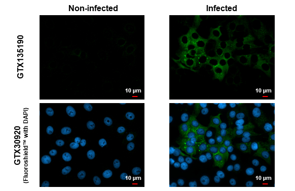 Chikungunya virus nsP4 antibody